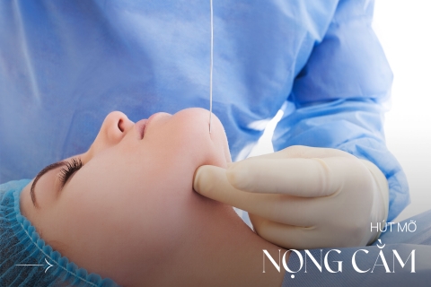 Hút mỡ nọng cằm
